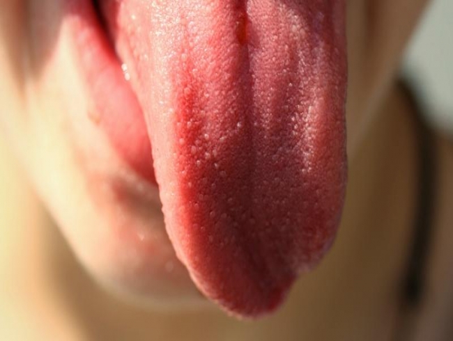 Pregnant wife bites off man’s tongue while kissing as he wasn’t ‘good looking’ Pregnant wife bites off man’s tongue while kissing as he wasn’t ‘good looking’