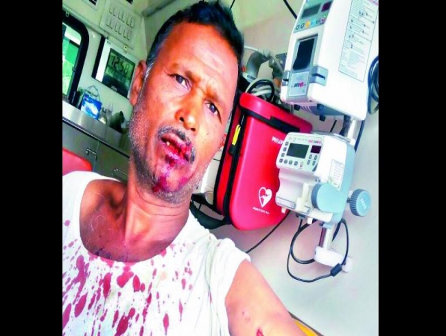 Telangana: Hyena injures farmer