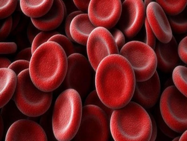 Hyderabad: Unit to trace sickle cell anaemia patients
