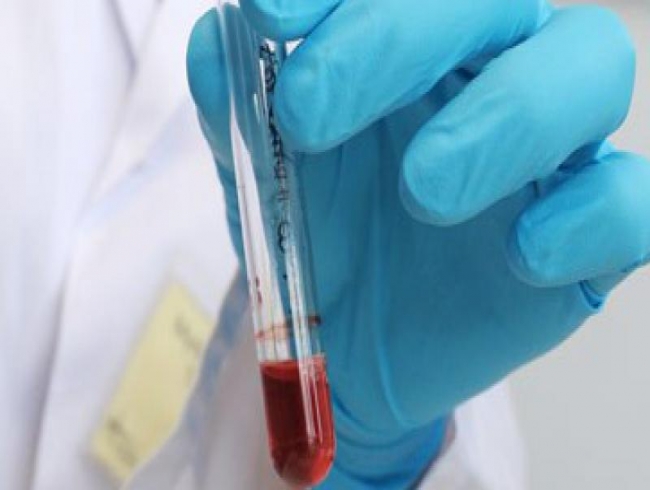 Simple blood test can measure a person's internal body clock
