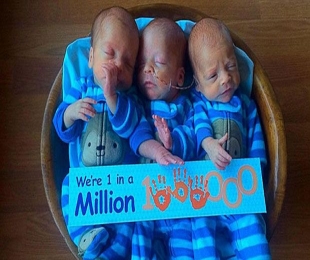 1-in-Million identical triplets born to Montana couple