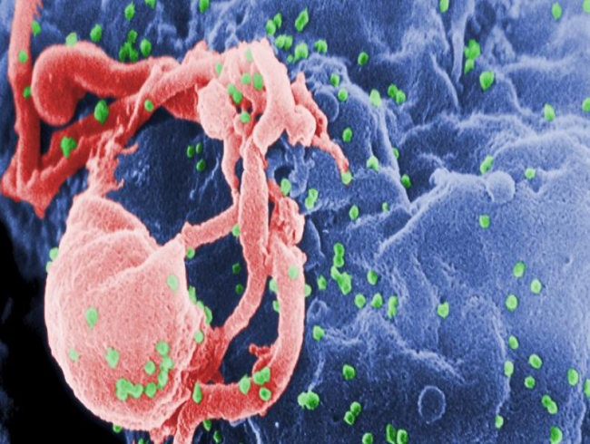 Scientists discover last unknown structure of HIV virus