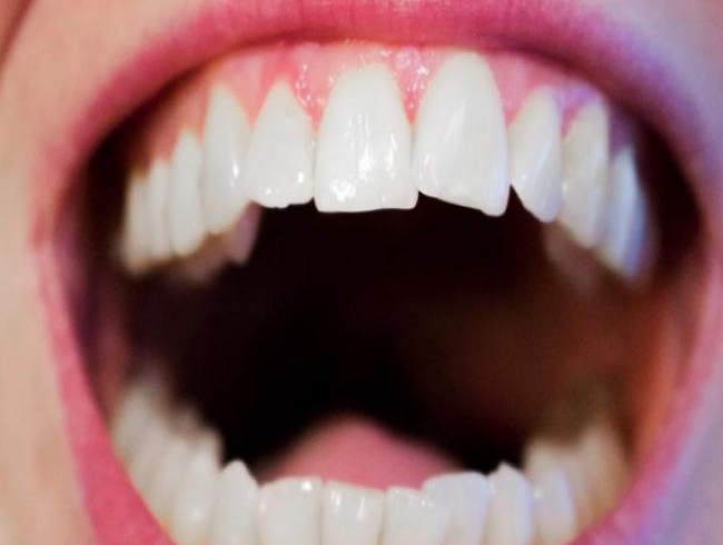 Here's a safe and effective way to whiten teeth