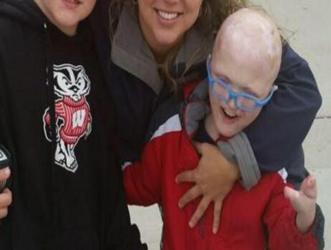 9-year-old unable to cry or sweat due to rare disorder