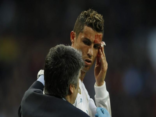 Cristiano Ronaldo's injury vs Deportivo La Coruna could have been worse: Real Madrid